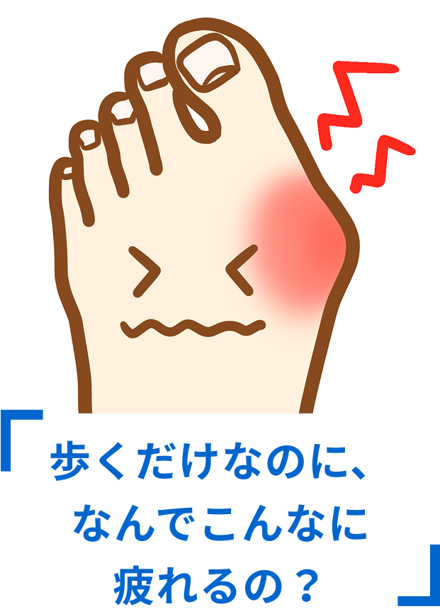 歩くだけなのに、なんでこんなに疲れるの？